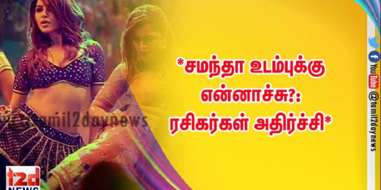 *சமந்தா உடம்புக்கு என்னாச்சு?: ரசிகர்கள் அதிர்ச்சி*